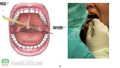 咽拭子标本采集法视频,咽拭子标本采集法视频教程概述